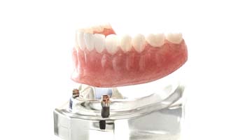 implant dentures in Brick Township