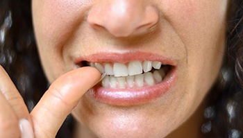 Woman biting thumbnail with her dental implants in Brick Township